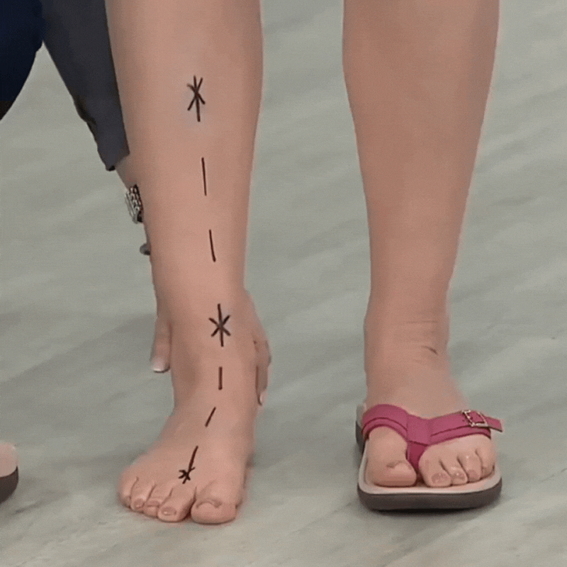 Comfortable Orthopedic Sandals for Daily Wear